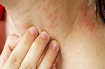 skin disease care image